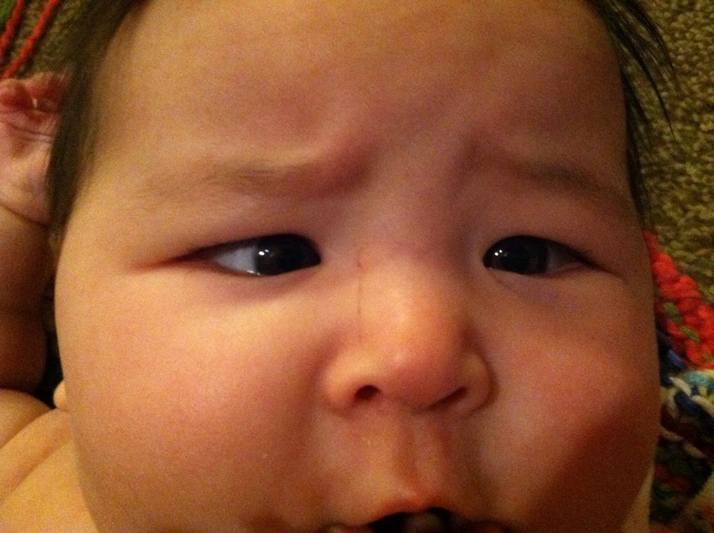 Crosseyed appearance? *Pic* BabyCenter